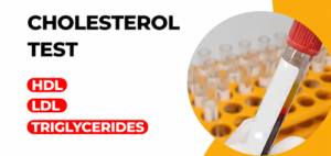 Cholesterol test graphic showing a blood sample test tube, with text listing HDL, LDL, and triglycerides.